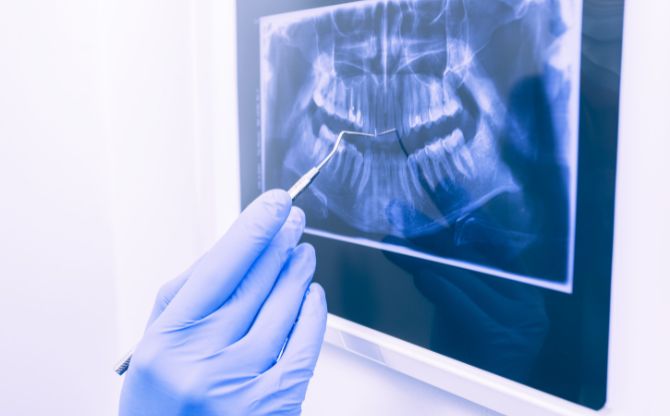 AGGA Dental Device Lawsuit AGGA Dental Device Lawsuit