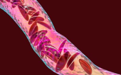 Sickle Cell Disease Awareness and the Oxbryta Lawsuit