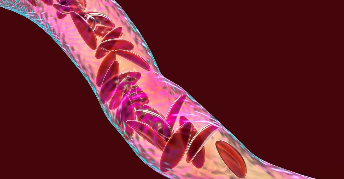 Sickle Cell Disease Awareness and the Oxbryta Lawsuit