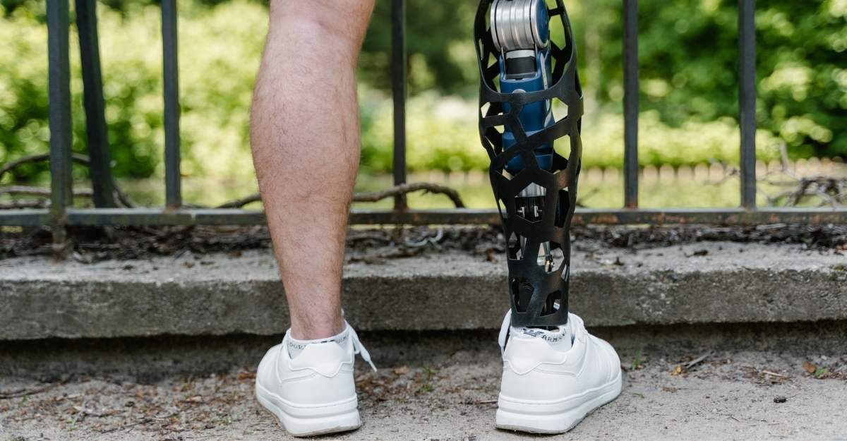 New Orleans Amputation Injury Attorney – Lifetime Costs Guide