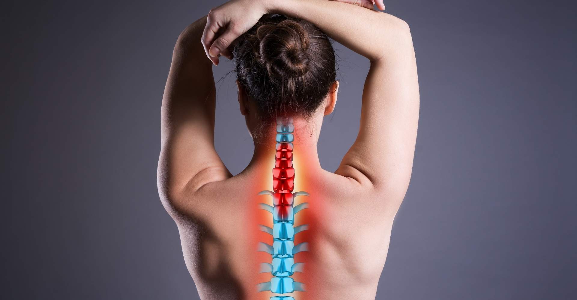 Spinal Cord Injury Compensation After Car Accident in Louisiana