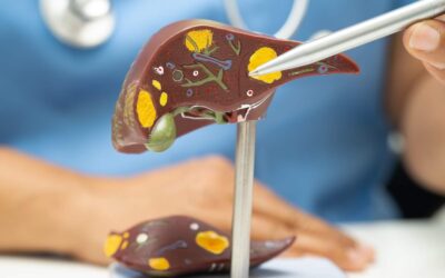 Ocaliva Liver Damage: Critical Warning Signs You Should Know