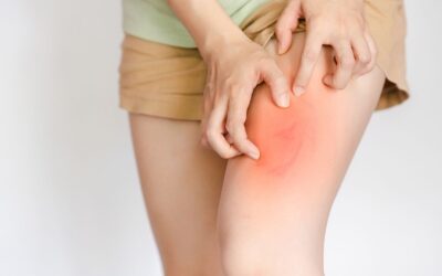 Ocaliva Side Effects: From Severe Itching to Liver Failure