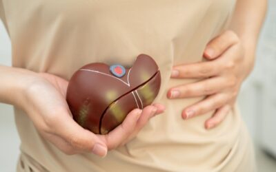 Ocaliva Lawsuits: Cirrhosis, Decompensation & Risk