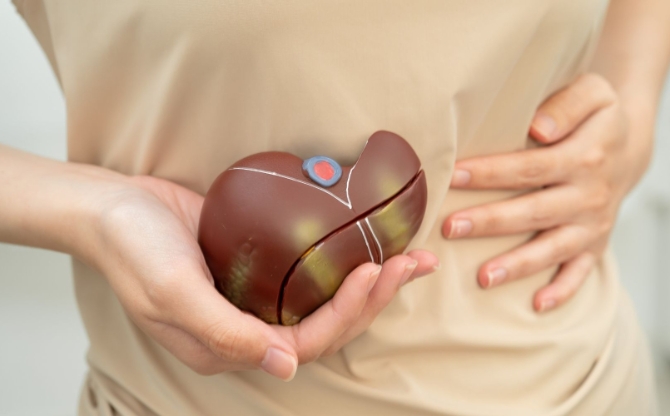 Ocaliva-Lawsuits-Cirrhosis-Decompensation-Risk(1) FDA Warns of Serious Liver Risks with Ocaliva